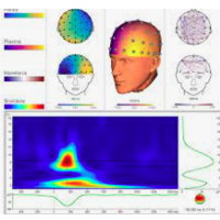  EEG Data Analysis upgrade free of charge until December 31, 2021 - Analyzer 2.2.1