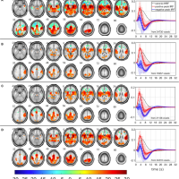Blind Visualization of Task-Related Networks From Visual Oddball Simultaneous EEG-fMRI Data: Spectral or Spatiospectral Model?