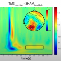 EEG NIRS TMS Eye Tracking: fMRI-EEG, fNIRS-EEG, TMS-EEG and TMS-fMRI